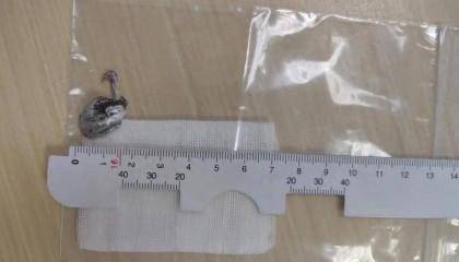 700°C！浙江男子瞬间失明！紧急提醒