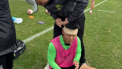 博主：国安冬训强度够激烈，方昊训练场挂彩头缠绷带