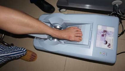 骨质流失的危害你知道多少？不是只有老年人才会流失骨质！