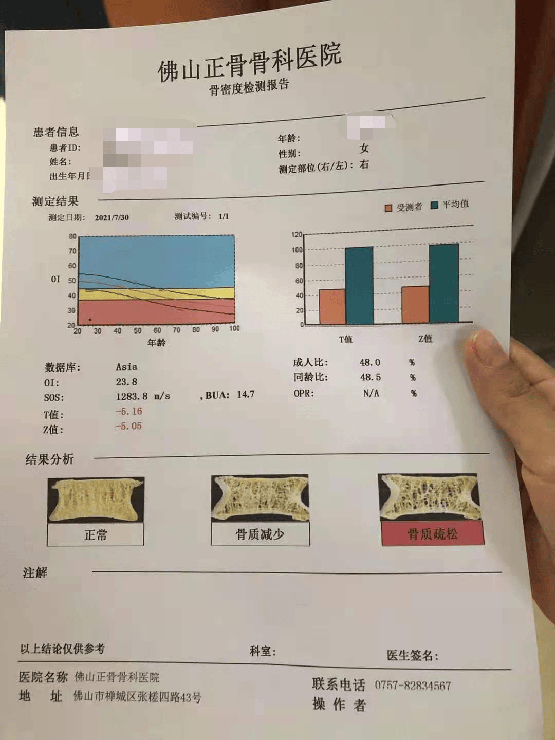 骨质流失的危害你知道多少？不是只有老年人才会流失骨质！