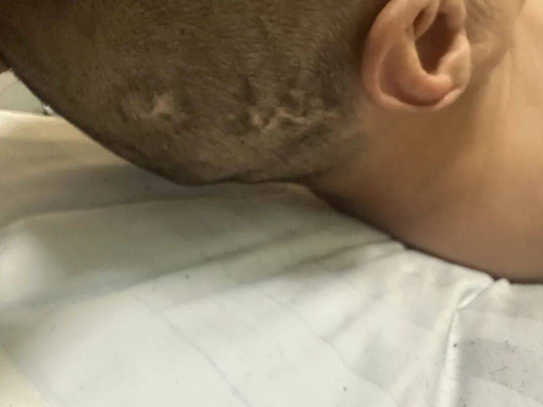 4名游客景区内遭马蜂袭击,旅游度假区:是森林公园不卖门票,蜇伤先就医后提供证据投诉